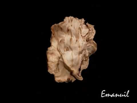 DRIED CABBAGE-Kim Wilde-You Keep Me Hangin' On