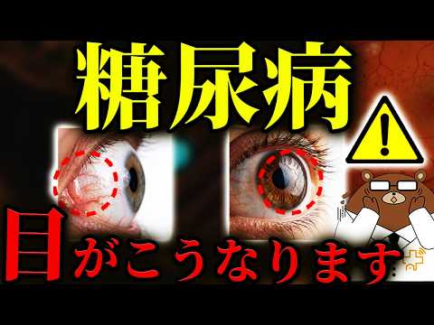 放置厳禁！知らないと後悔する糖尿病の「目」の初期症状。かすみ・ゆがみ・飛蚊症..絶対に見逃してはいけない失明の危険サインとは？自分で気づける目のチェック方法とは？医師が徹底解説！