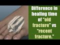 Difference in healing time of old fracture vs recent fracture