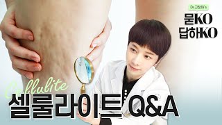 여성들의 공공의 적, 셀룰라이트 Q&A