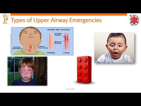 PALS Respiratory Pecha Kucha- Brad Owens