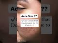 Treat Your Acne Marks Shorts Yoitubeshorts