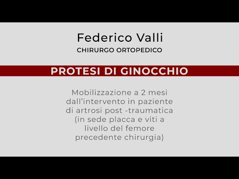 Quali pillole bevuto di mal di schiena Cambiamenti nelle articolazioni delle mani