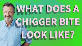 What does a chigger bite look like