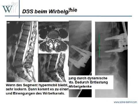 Video dynamische Stabilisierung