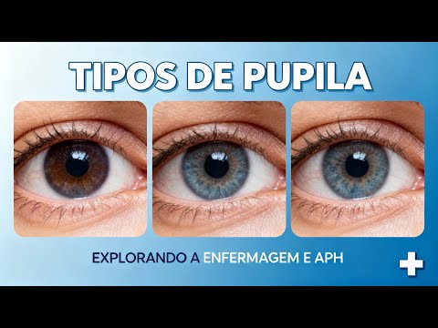 Como Avaliar as Pupilas? Aprenda os 4 Tipos e o Que Cada Uma Significa!