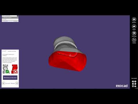 Exocad 15 Primär Sekundär-Teile Teleskop gleichzeitig