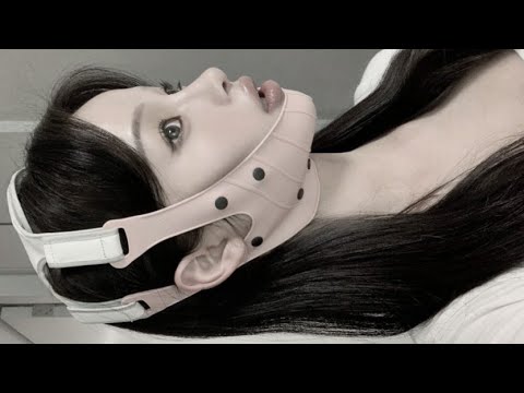 ✨[PAID REQ]✨Jaw reduction + Cheekbone reduction + Chin geni0plasty(FORCED)⚠️