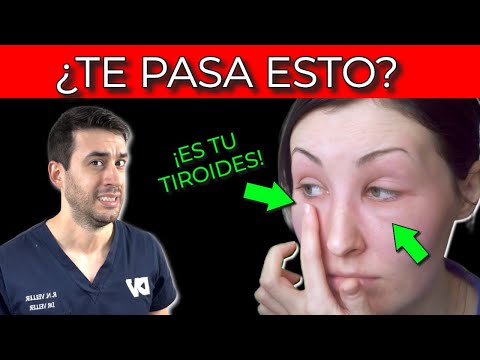 , title : 'ASI EMPIEZAN los problemas de TIROIDES y nadie te lo dice| Signos y síntomas de HIPOTIROIDISMO'