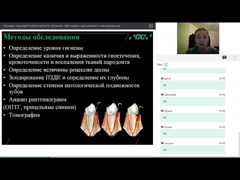 Адгезивное шинирование. Основы пародонтологического лечения (Вебинар от 17.11.17)