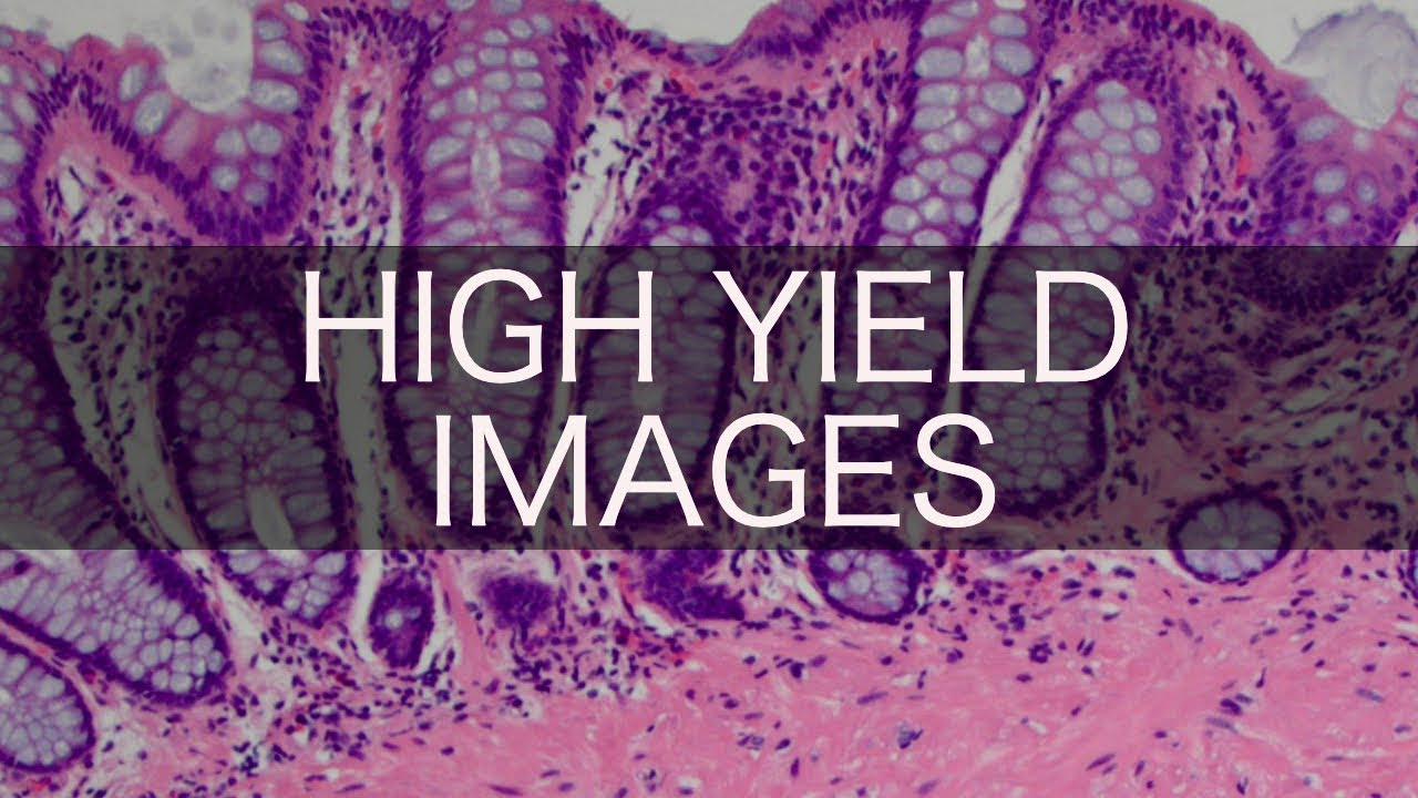 High Yield USMLE/COMLEX Images (pt. 7)