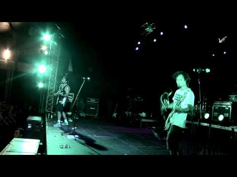 Video thumbnail for Фиолетовый фингал (Purple shiner)