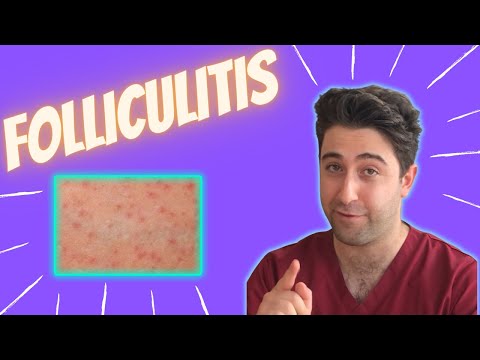 Folliculitis under FIVE minutes