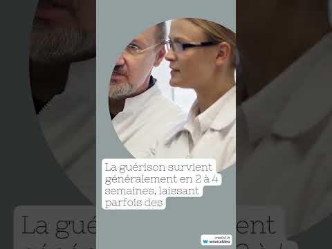 Vidéo : zona intercostal — Dr Rousseau, dermatologue Bordeaux