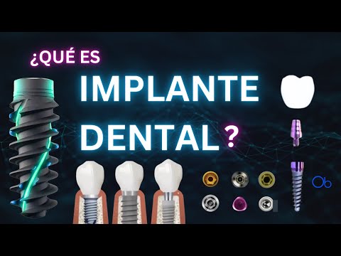¿Qué es un IMPLANTE DENTAL? 🔩 🦷