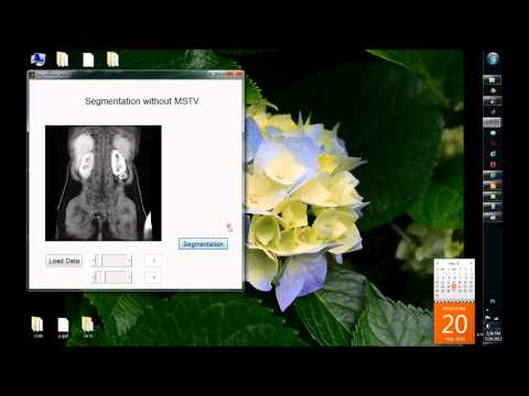 Automatic Segmentation of Renal Compartments from DCE-MRI Images
