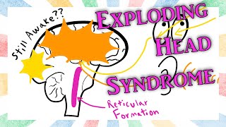 Exploding Head Syndrome. The Ways Your Brain Can Break