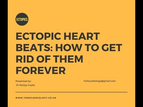 Ectopic heart beats: Getting rid of them for good