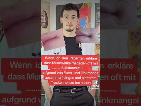 Mundwinkelrhagaden Gesundheitstipps#Medizin#doctor