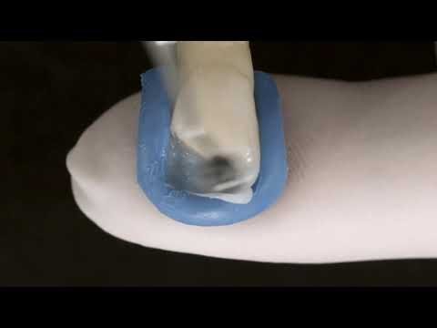 Tetric N Line (Ivoclar Vivadent)