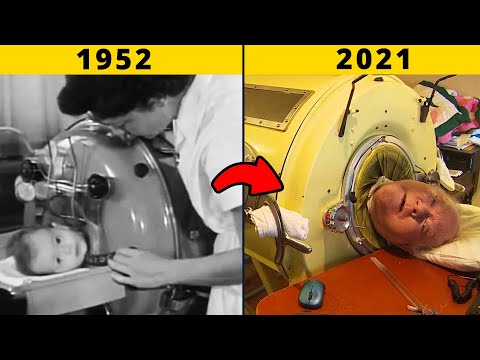 The Man In The Iron Lung |  Man Locked In This Machine For Almost 70 Years