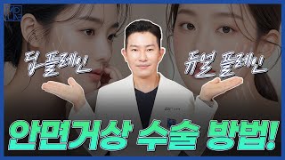 안면거상, 수술법 따라 결과가 달라진다? 딥플레인 vs 듀얼플레인 비교!