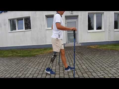 Od protezy tymczasowej do ostatecznej – nasz Pacjent Sławek