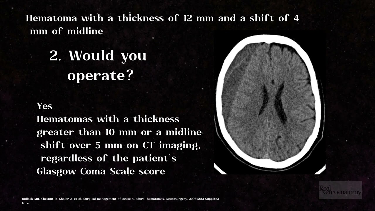 Victor Ramzes Chavez Herrera-10