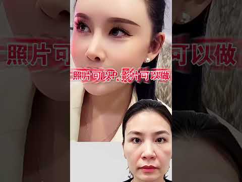 一般無痕筋膜拉提,效果不夠持久?擔心拉皮手術,恢復期太長?
