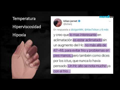 Charla de Zigor Madaria sobre la autopsia de Iñaki Ochoa de Olza