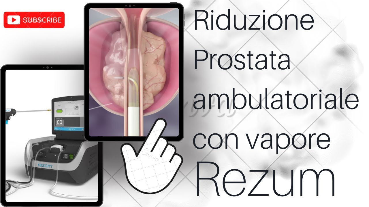 Pier Andrea Della Camera-19