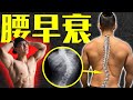 健身10年,身材有了,健康没了!30岁的年纪 50岁的腰!