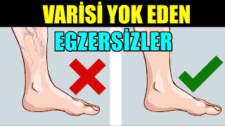 Bacaklardaki VARİSİ TEDAVİ EDEN Egzersizler