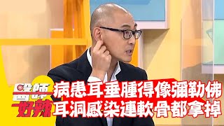 病患耳垂腫得像「彌勒佛」 耳洞感染連「軟骨」都要拿掉？！【#醫師好辣】20220614 part2 EP1350 鄭丞傑 鍾雲霓