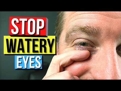 How To STOP EYES From WATERING! - Top 5 Causes and Remedies For Watery Eyes