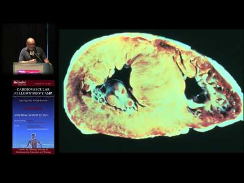 Syncope (J.B. Durand, MD)