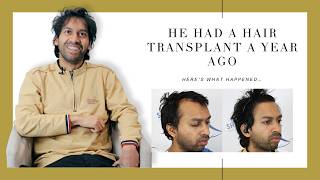 Canadian Hair Transplant Centre