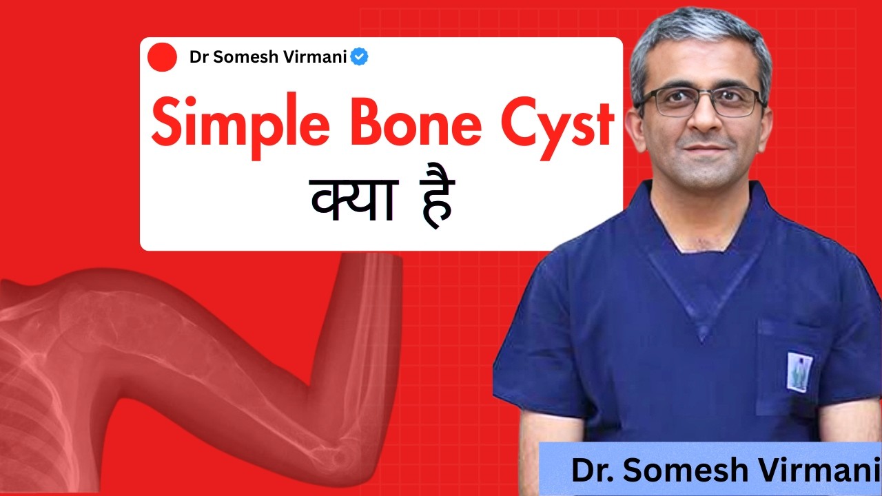 Simple Bone Cyst क्या है? | Cyst कितना खतरनाक हो सकता है? | Dr. Somesh Virmani