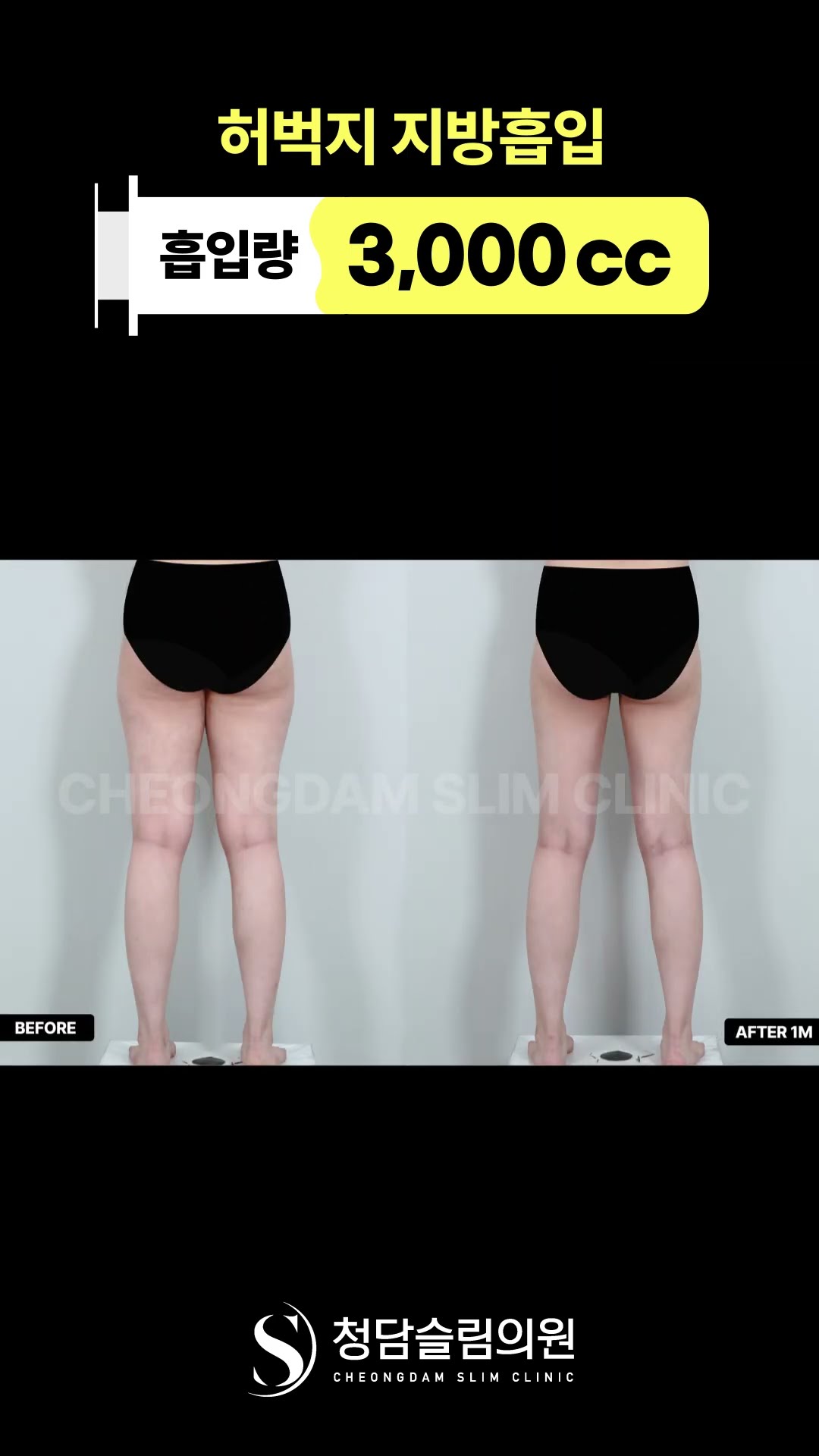 다리 비율 좋아보이는 마법 🪄