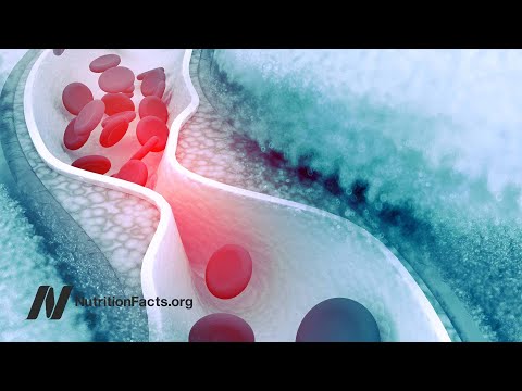 Saturated Fat Causes Artery and Lung Inflammation