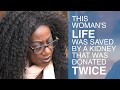 Rare Transplant Procedure Could Save Lives Change Field UCLA Health Newsroom