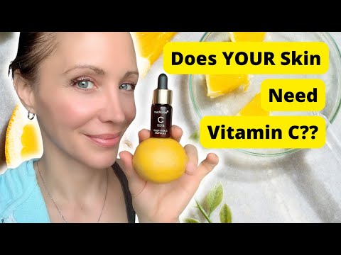 The Benefits of Vitamin C and Why YOUR Skin Needs It!