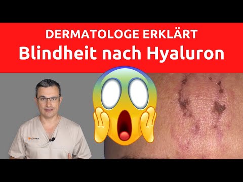 BLINDHEIT DURCH HYALURON-FILLER. DAS MÜSSEN SIE VOR EINER BEHANDLUNG WISSEN.