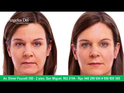 Soft Lift
