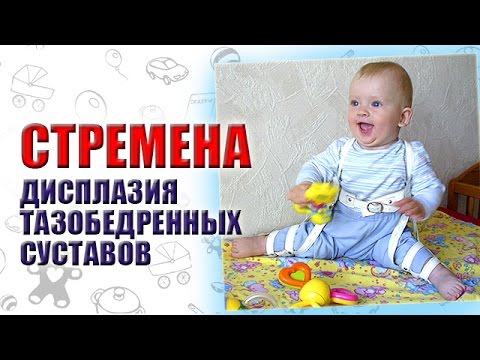 Стадии дисплазии тазобедренного сустава Суставная щель коленного сустава неравномерно сужена