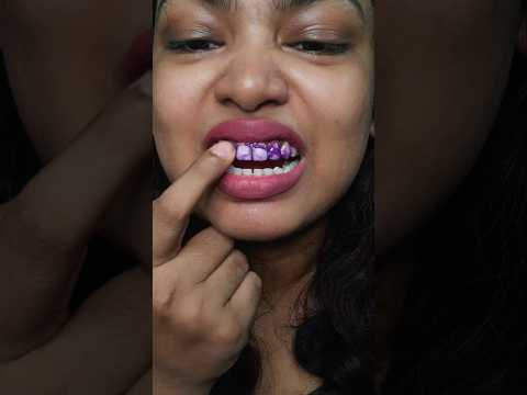 ഇത് കൊള്ളാല്ലോ?!! 😱🧐Perfora purple teeth whitening strips review Malayalam