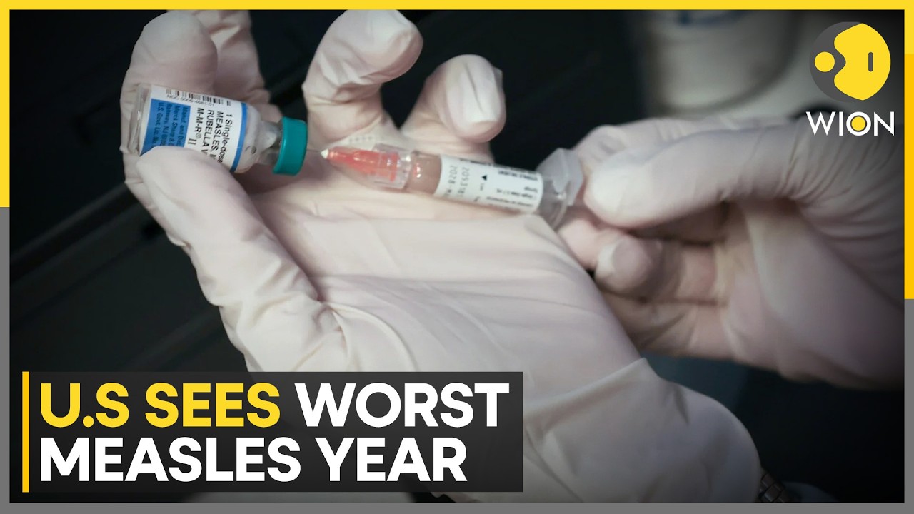 New York Measles Outbreak: US Records Nearly 3,900 Measles Cases; Vaccination Efforts Expanded |WION