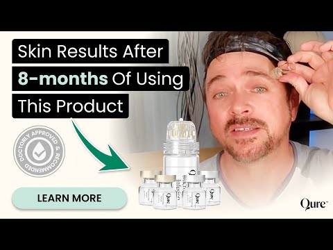 Skincare Expert Trades In Expensive In-Clinic Micro-needling Treatments For This At-Home Device