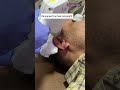 Permanent Ear Hair Removal 100 Safe ️ Painless Guaranteed Result