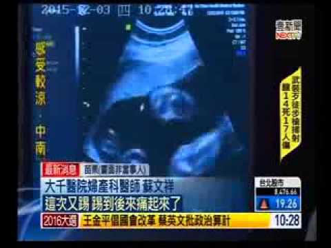 104 12 03壹電視：女寶寶無影腳踢  媽媽子宮破大洞